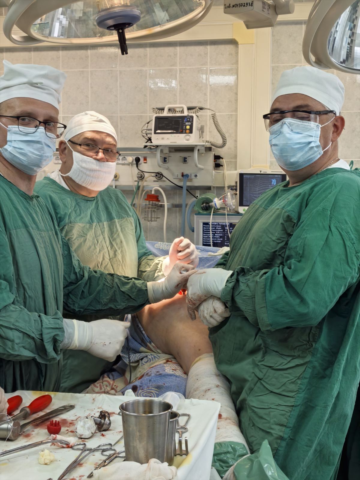endoscop