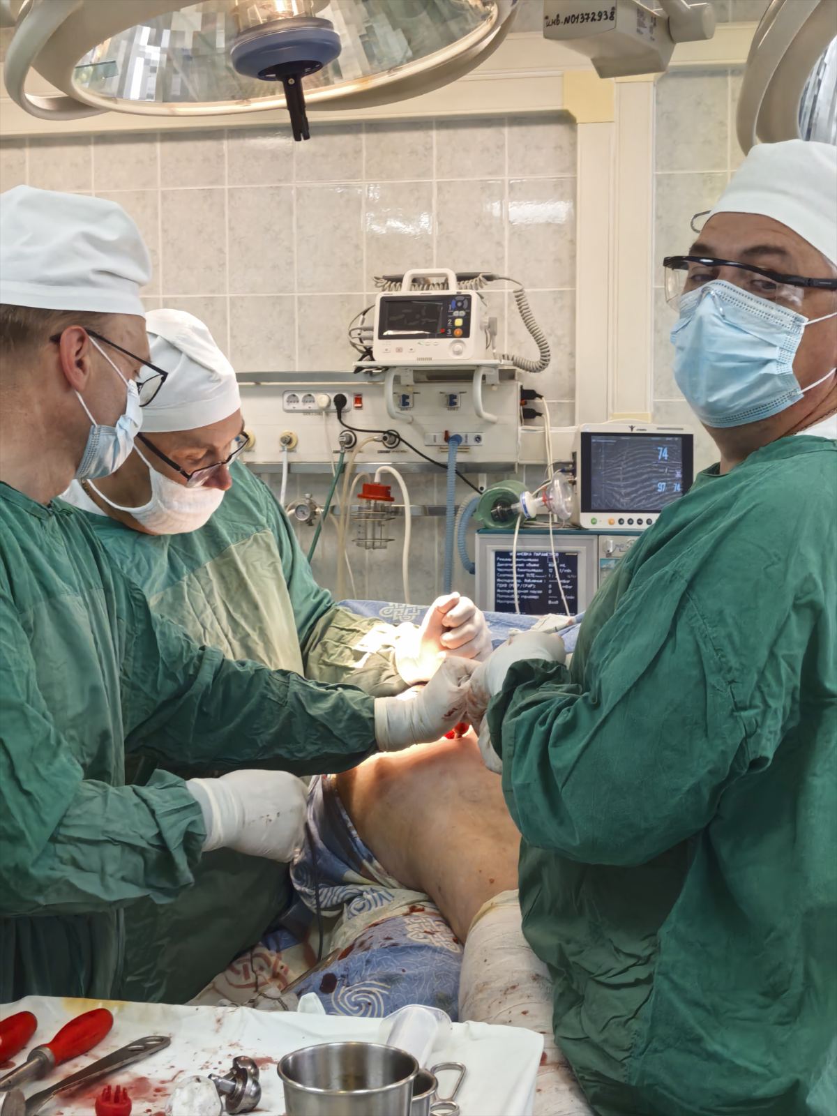 endoscop2